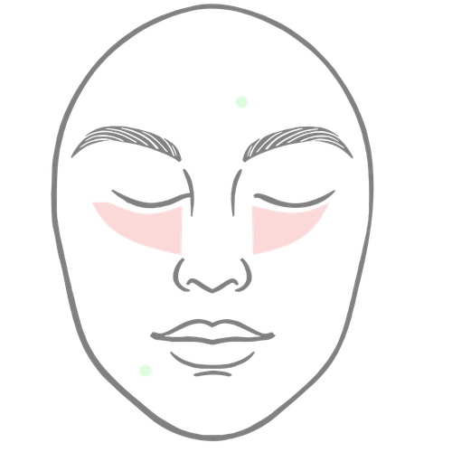 Недостатки кожи